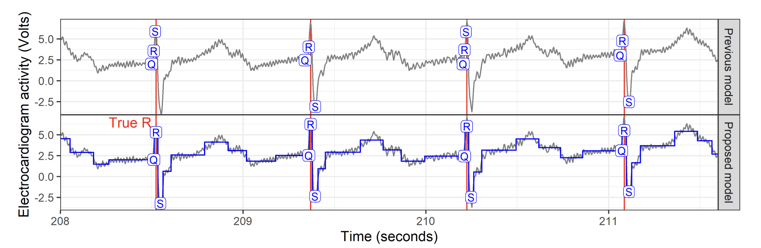Electrocardiogram trace with Q, R, and S wave labels, detected changepoints, and a piecewise-constant fit.